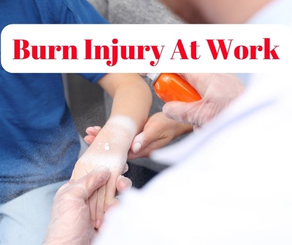 Burn Injury At Work